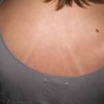 Nice tan lines!